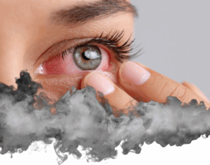Woman's red eye and smoke