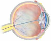 Open Angle Glaucoma