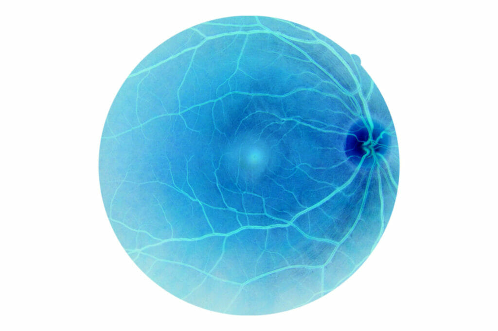 Retina and optical nerve