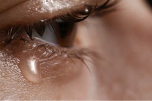 Teary eyes