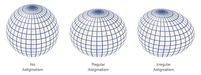 astigmatism sphere vibrax