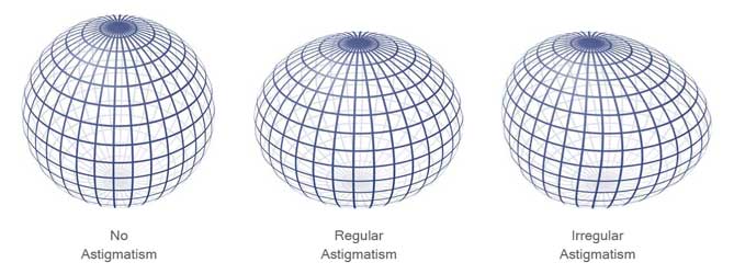 astigmatism spheres