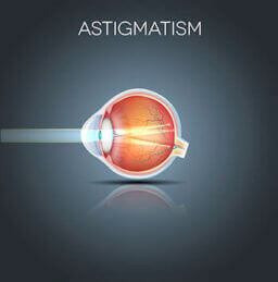 Astigmatism diagram