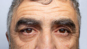 Close up of older man's eyes