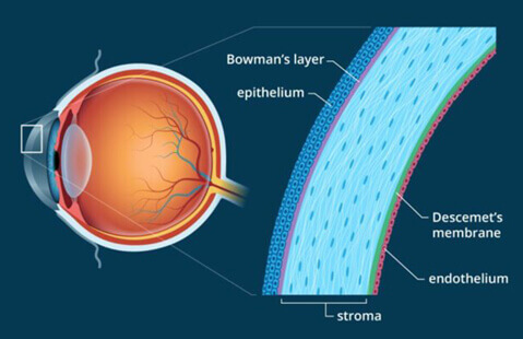 corneal degeneration treatment