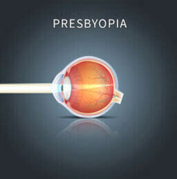 Presbyopia